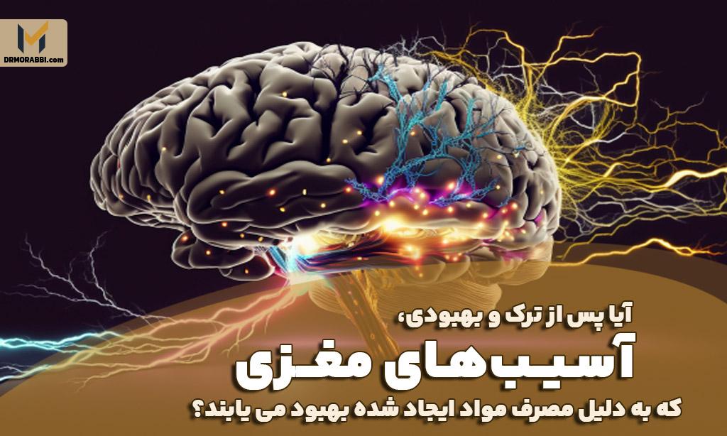 آسیب‌های مغزی